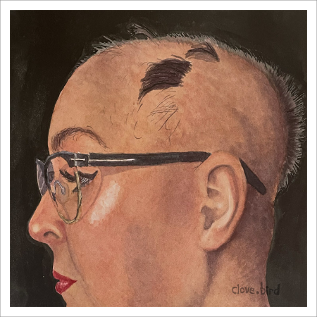 Alopecia Print