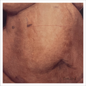 Gallbladder Scar Print